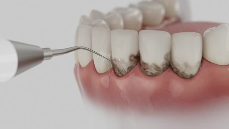 Reliable Dental contractor in Lake Norman of Catawba, NC by Dentist Open Now